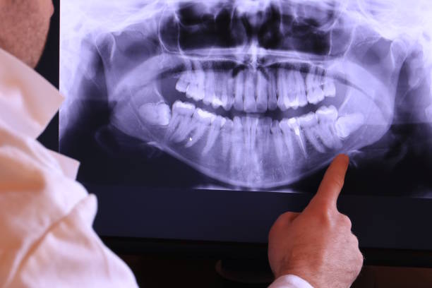 Best Pediatric Emergency Dentist in Aloha, OR
